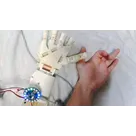 ECG Controlled Robotic Hand